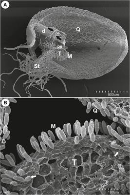 The Trap Architecture of Utricularia multifida and Utricularia westonii (subg. Polypompholyx)